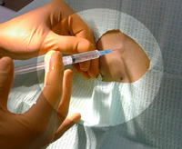 Khi bị kim tiêm (nghi ngờ nhiễm HIV) đâm chảy máu, xử lý như thế nào?