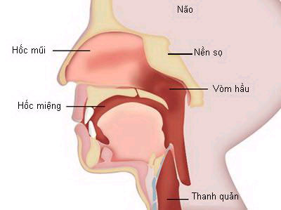 ung-thu-vom-hong