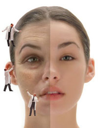 XOÁ NẾP NHĂN BẰNG BOTULINIUM TOXIN TYPE A (BOTOX, DYSPORT)