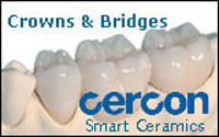 cercon