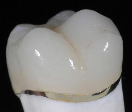 captek