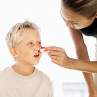 SƠ CỨU NGƯỜI BỊ CHẢY MÁU MŨI