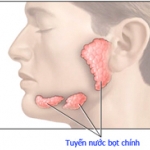 Ung thư tuyến nước bọt