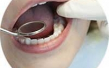Tại sao có người sau nhổ răng thì đau rất nhiều có khi kéo dài hàng tuần? 