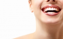 Niềng răng móm kèm răng chen chúc 