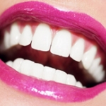 Có nhiều vấn đề mà bệnh nhân chưa biết khi đi tẩy trắng răng 