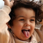 Răng cửa rất dễ bị chấn thương