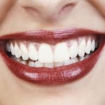 Những bệnh trong miệng dễ bị bỏ qua