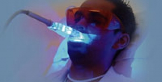 Tẩy trắng răng bằng ánh sáng laser-plasma