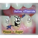 Trị sâu răng sớm bằng men răng tổng hợp