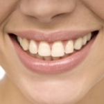 NHỮNG ĐIỀU CẦN BIẾT TRƯỚC KHI TẨY TRẮNG RĂNG: 