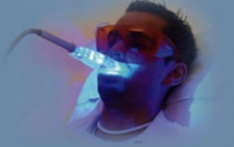 Tẩy trắng răng bằng ánh sáng laser-plasma