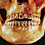 Răng cẩn đá quý 2.500 năm trước
