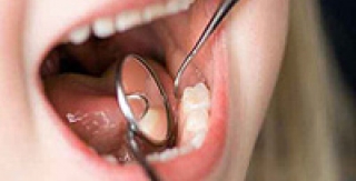 Quá trình chỉnh hình răng ở trẻ được tiến hành như thế nào? 