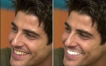 Tẩy trăng răng...có khuyến mãi