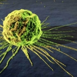 Ung thư: biết sớm trị lành