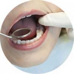 Bệnh nha chu có thể làm mất răng