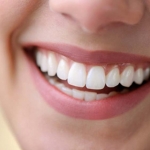 Giải pháp toàn diện cho nụ cười đẹp