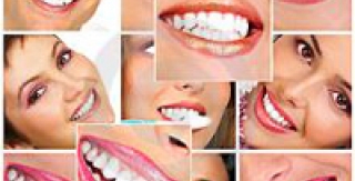 "Sát thủ" của răng miệng 