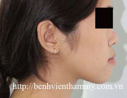 07ket-thuc-dieu-tri1