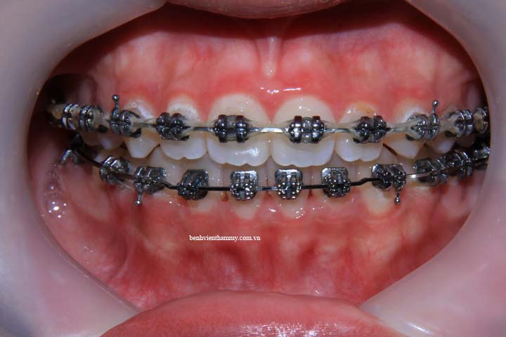 ho 3