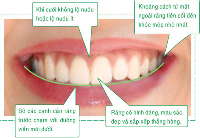 nu-cuoi-dep-hoan-hao-7