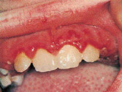 loet-mieng-2