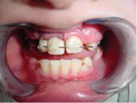 rang-roi-khoi-o-o-tre-5